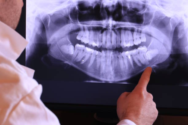 Best Holiday Emergency Dentist in Markham, IL