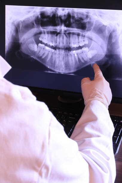 Best Emergency Dental Care for Abscessed Tooth in Markham, IL